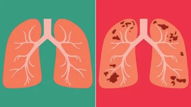 The increasing number of TB patients has raised concerns, efforts to prevent it have intensified in Uttarakhand